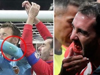 Фото дня: Годин потерял несколько зубов в столкновении с вратарём "Валенсии"
